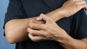 Asian young man scratching his hand isolated on blue background.